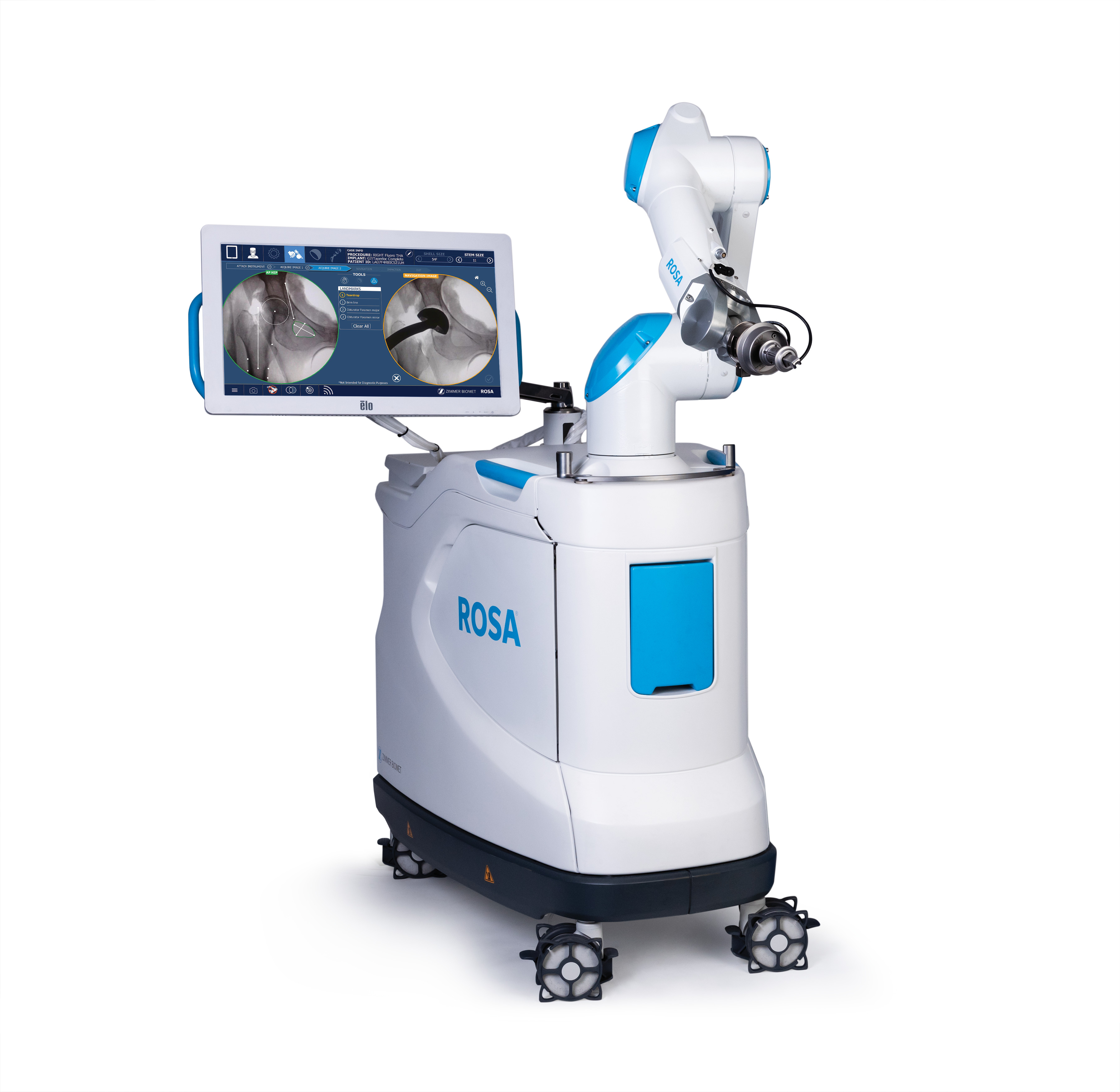 ROSA Robotic Hip Replacement system